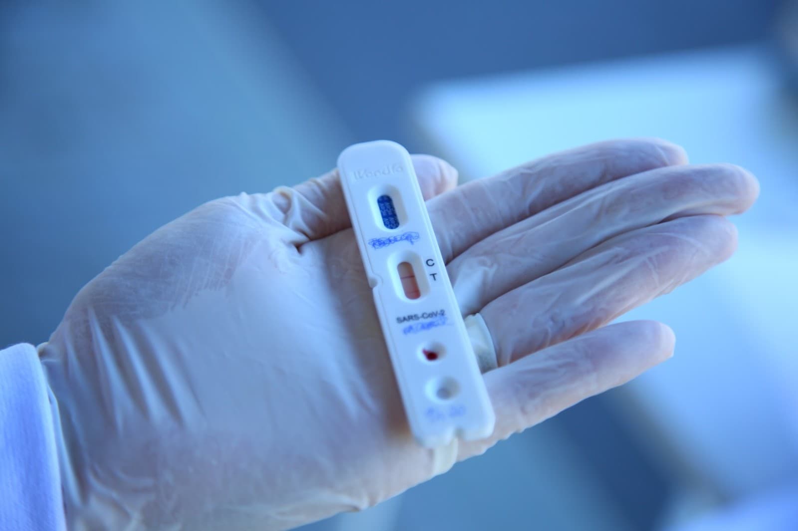 Bebê de 20 dias testa positivo para novo coronavírus