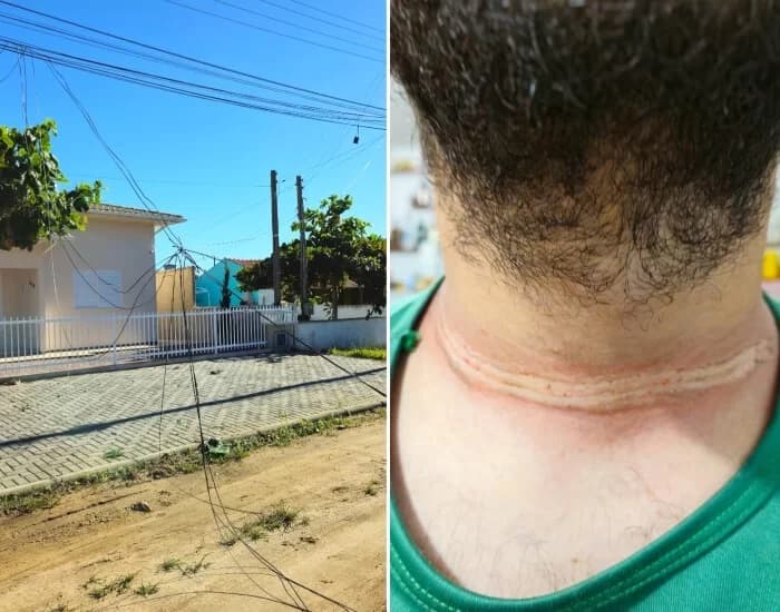 Motociclista quase é enforcado por fio de telefonia solto