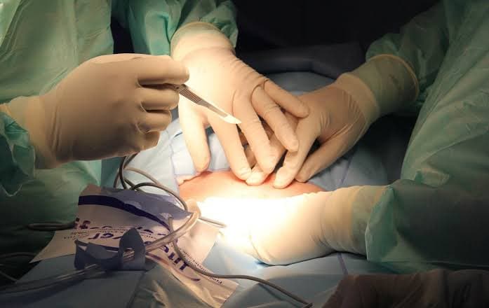 Homem precisa ser submetido a cirurgia para tirar pacote de maconha do estômago