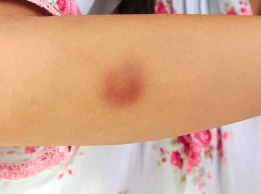 Professora é afastada de creche por suspeita de agressão a criança de 2 anos