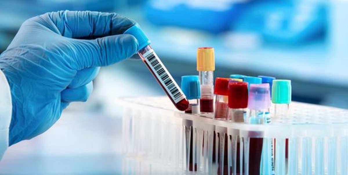 Tubarão atinge a marca de 16 mil exames PCR realizados