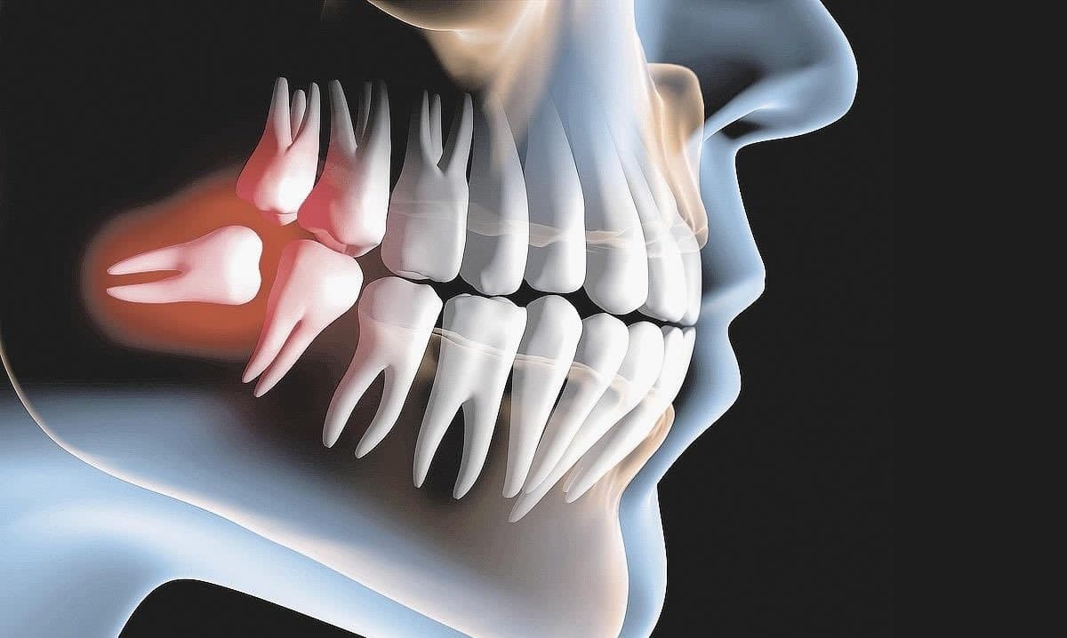 Doutor, preciso perder o “juízo”?