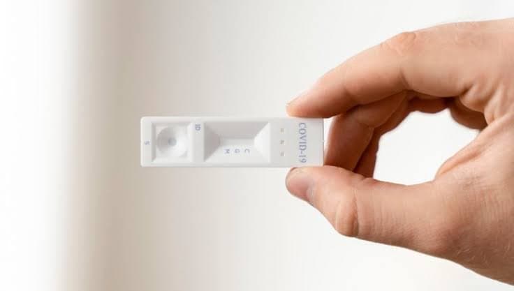 Imbituba compra mais de 5 mil testes para as influenzas A e B