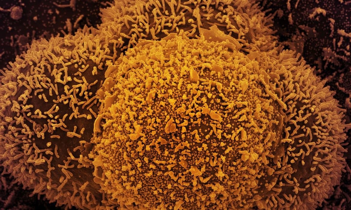 Linhagem BA.2 da variante Ômicron é detectada em SC