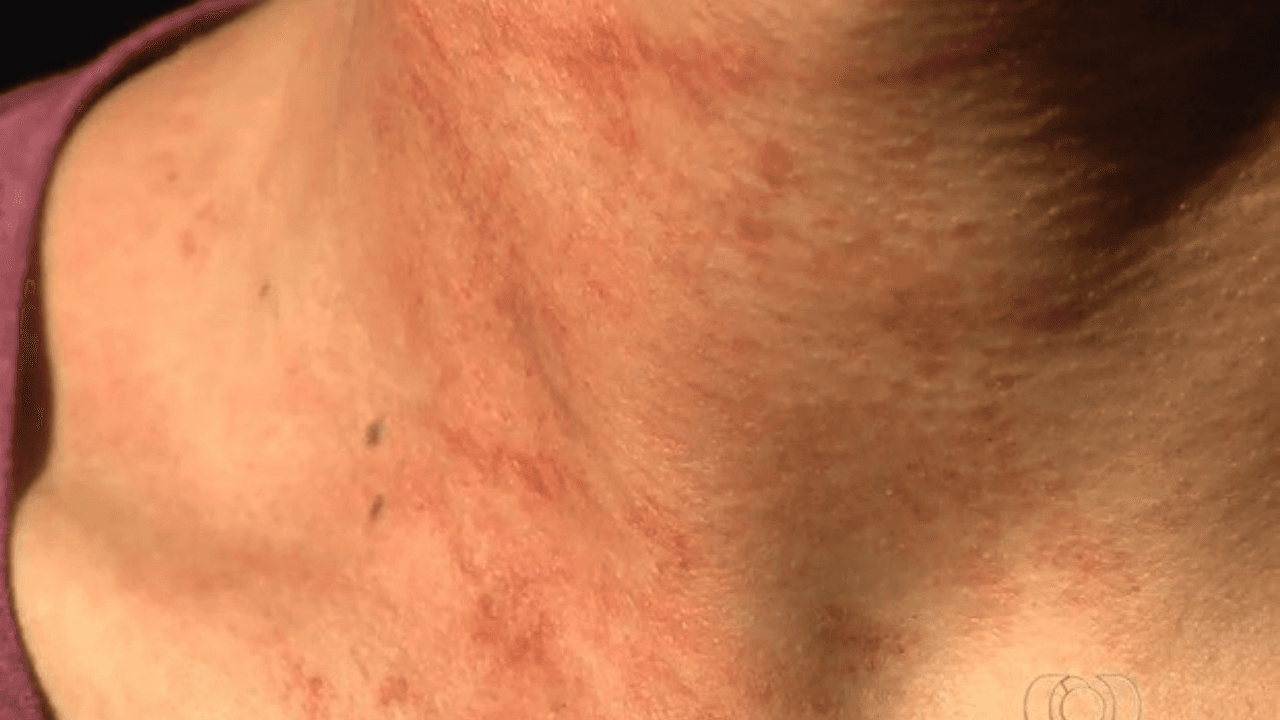 Ladrão tenta estrangular mulher na praia para roubar corrente