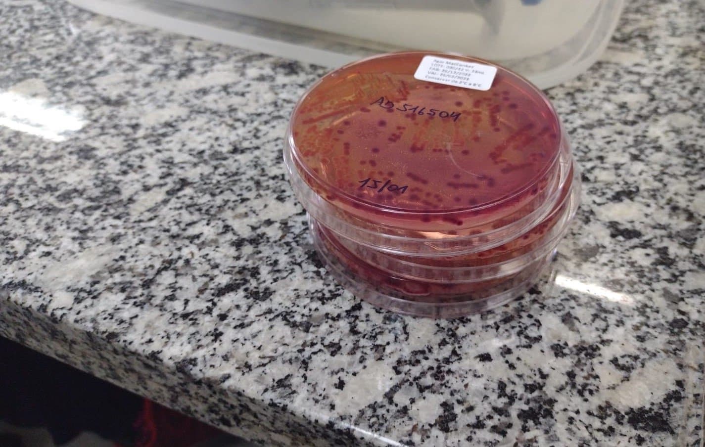 Análise de amostras de água é ampliada em SC devido ao aumento de casos de doenças diarreicas