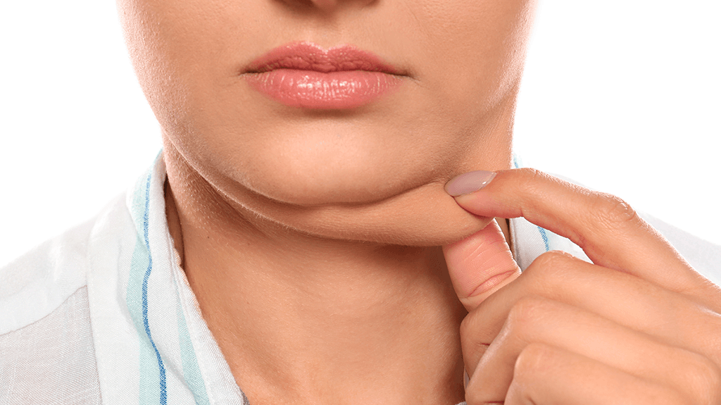 Você sabia? Uso do celular pode aumentar a formação da "papada"