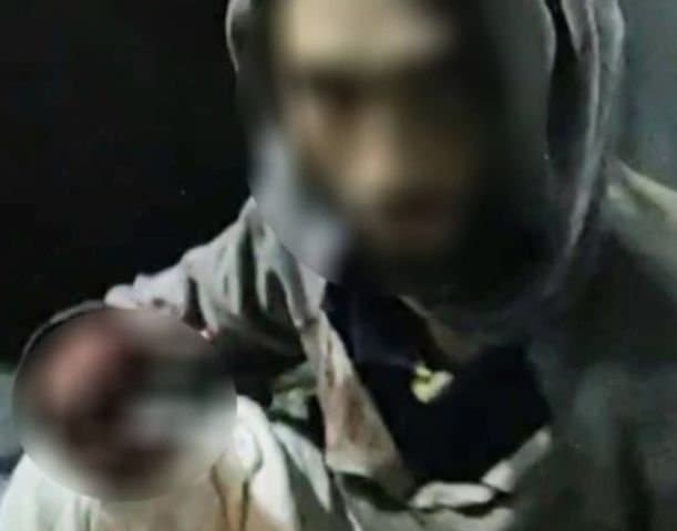 Acusado de furtar botijão de gás, morador de rua tem dedos amputados