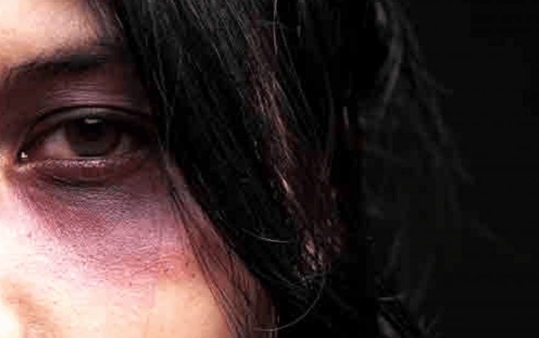 Mulher é agredida com socos e empurrões pelo marido