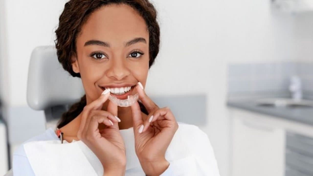 Alinhadores invisíveis: como eles funcionam?