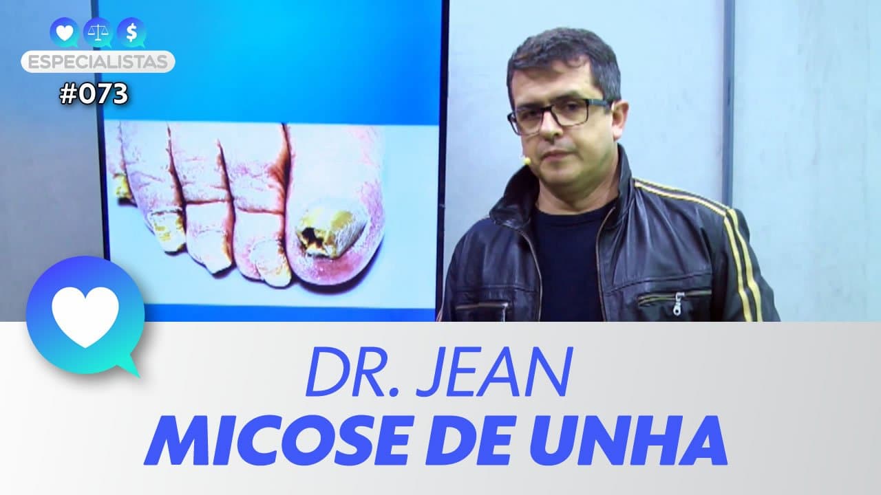 ASSISTA: Micose de unha / onicomicose – Especialistas #073