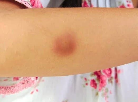 Professora é afastada de creche por suspeita de agressão a criança de 2 anos